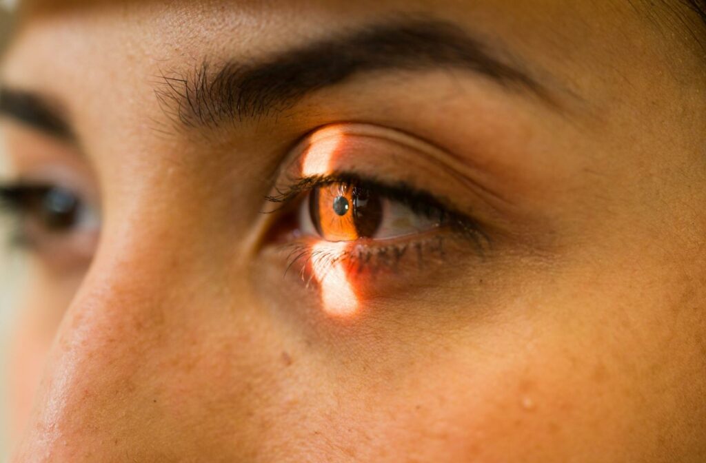 Close-up of an eye being examined with a slit lamp during a comprehensive eye exam to evaluate the cornea, iris, and other front eye structures.